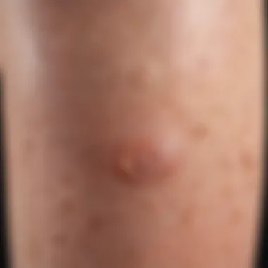 Close-up of keratosis pilaris on leg skin