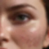 Close-up view of skin layers highlighting exfoliation