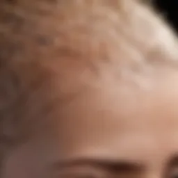 Close-up of a scalp showing dry spots